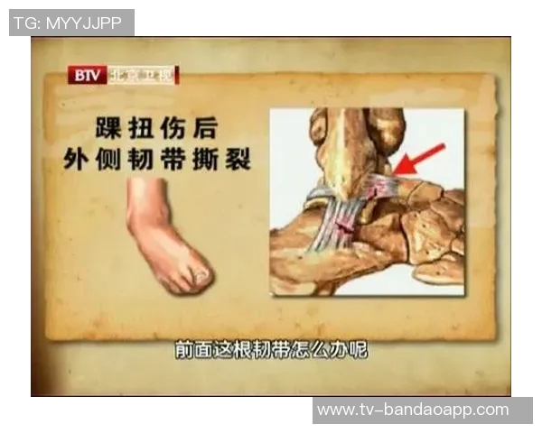 罗德里戈韧带伤势加重确诊十字韧带断裂背后隐患多年未愈